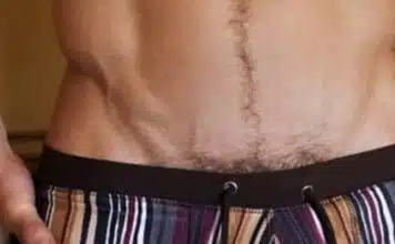 Comment fonctionne l’épilation du bikini pour les hommes ?